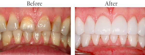 dental images 07631